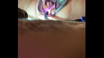 free mega boobs porn