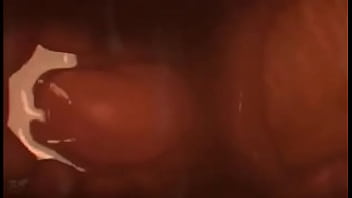 internal camera sex video