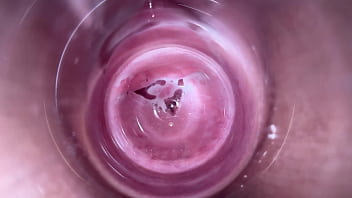 camera inside the anus