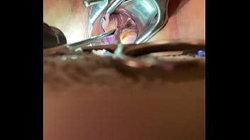 prostate finger porn