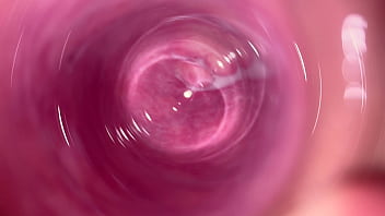 camera inside vagina during