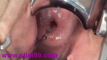 Speculum play