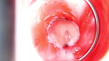 camera inside vagina during